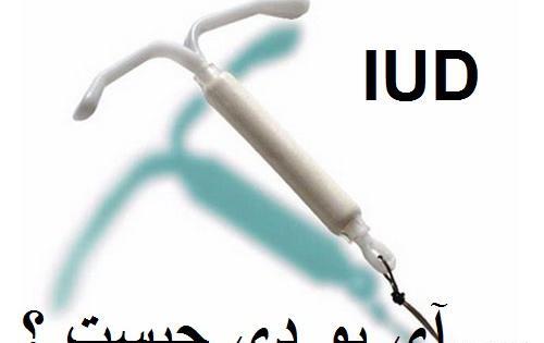 عکس آئودی در ایران