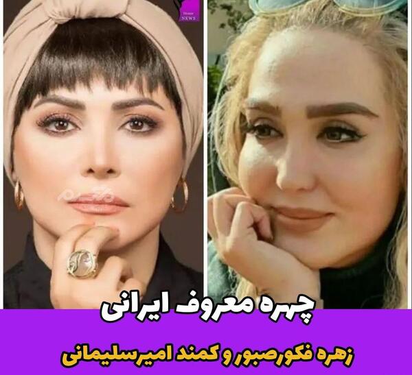 عکس زهره فکور صبور قبل از عمل زیبایی