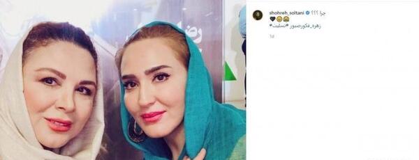 عکس زهره فکور صبور قبل از عمل زیبایی