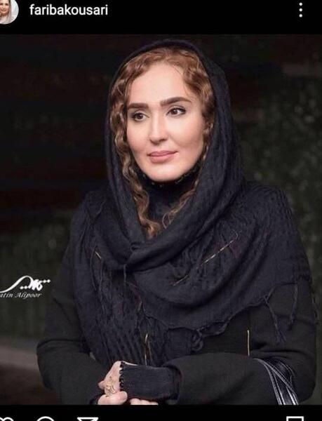 عکس زهره فکور صبور قبل از عمل زیبایی