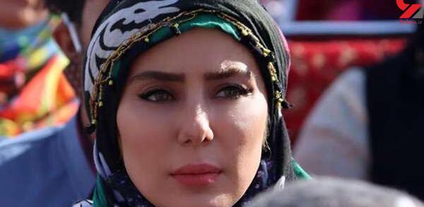 عکس واقعی صورت زخمی در فیلم بچه مهندس