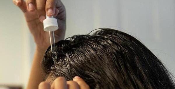 عکس شپش موی سر انسان