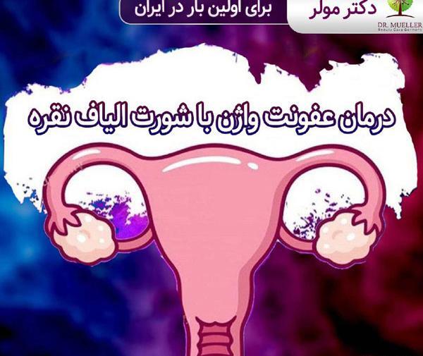 عکس واقعی عفونت قارچی واژن