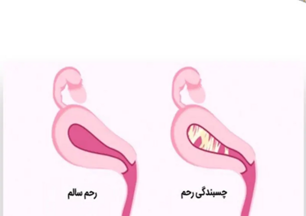 عکس ترنس اف تو ام