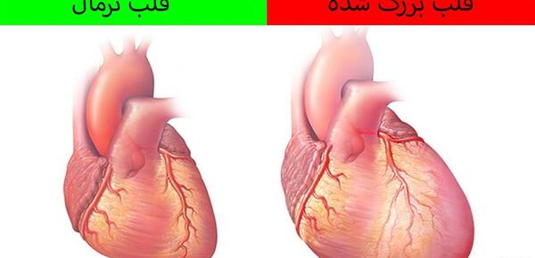 عکس ورزش قلب