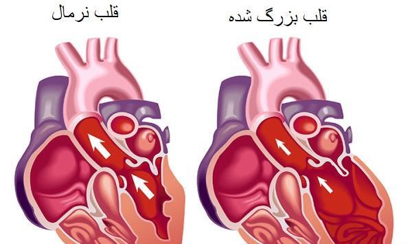 عکس ورزش قلب
