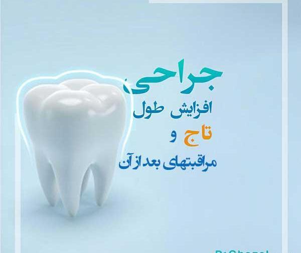 عکس توف سبز