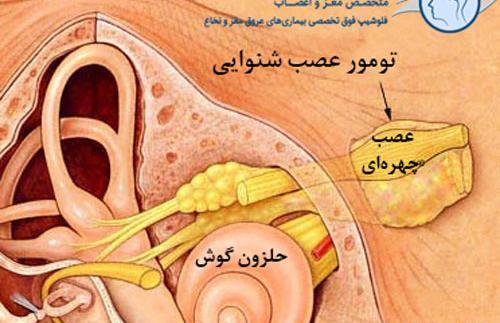عکس خوابیدن حلزون