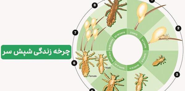 عکس شپش سر نوزاد