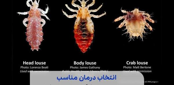 عکس سر پر از شپش