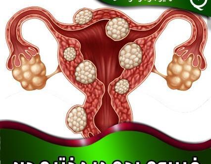 عکس ضخیم شدن دیواره رحم