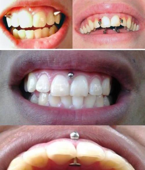 عکس نگین بینی حلقه ای