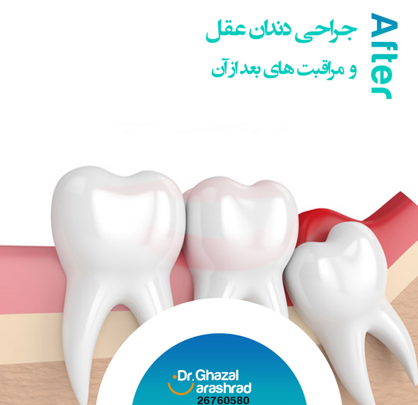 عکس یاس قبل از معروف شدن