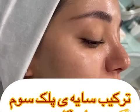 عکس نگین میرزایی