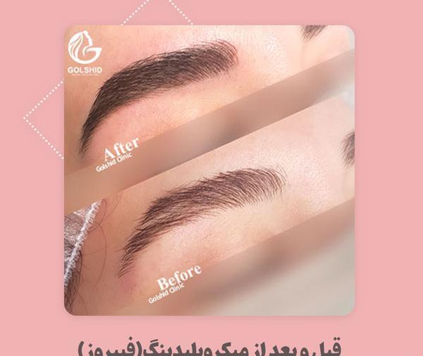 عکس بارداری نیکا فلاحی