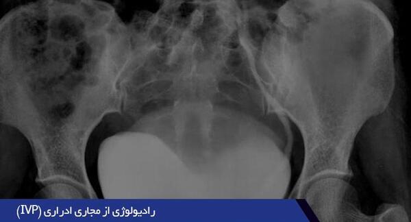 کیا عکس رنگی گرفتن باردار شدن