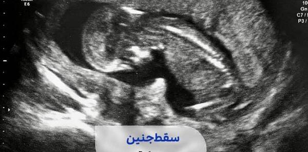 کیا عکس رنگی گرفتن باردار شدن