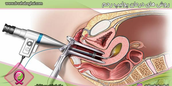 کیا عکس رنگی گرفتن باردار شدن