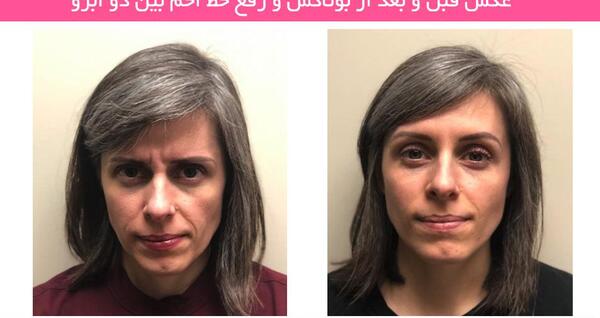 عکس سفید کننده صورت