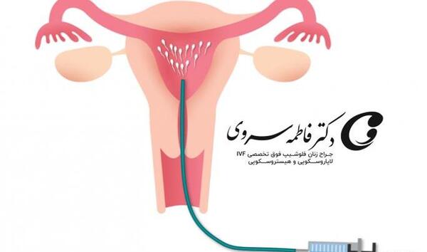 عکس با کیفیت آئودی