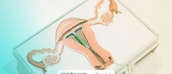 دانلود عکس آئودی