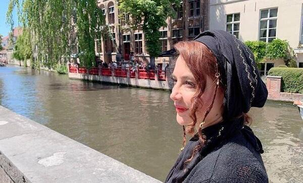 عکس نگین صدق گویا قبل از عمل بینی