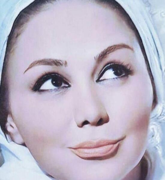 عکس نگین صدق گویا قبل از عمل بینی