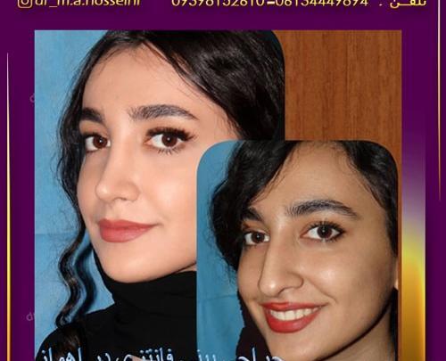 عکس خانم دکتر عروسکی