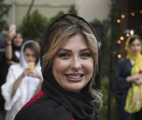 عکس نیوشا ضیغمی بعد از عمل بینی