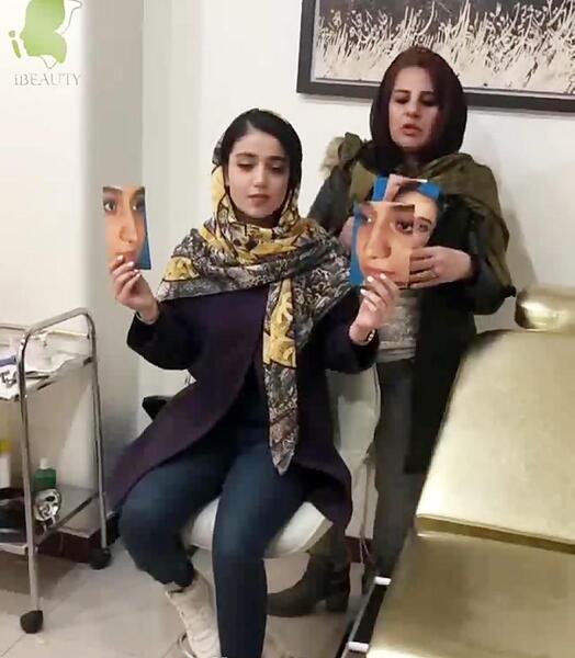 عکس نیوشا ضیغمی بعد از عمل بینی