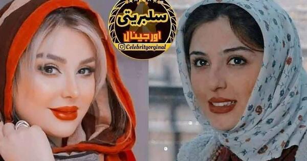 عکس نیوشا ضیغمی بعد از عمل بینی