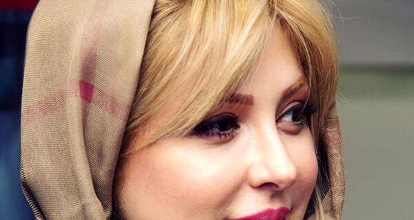 عکس نیوشا ضیغمی بعد از عمل بینی