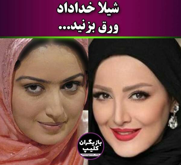 عکس نیوشا ضیغمی بعد از عمل بینی
