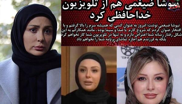 عکس نیوشا ضیغمی بعد از عمل بینی