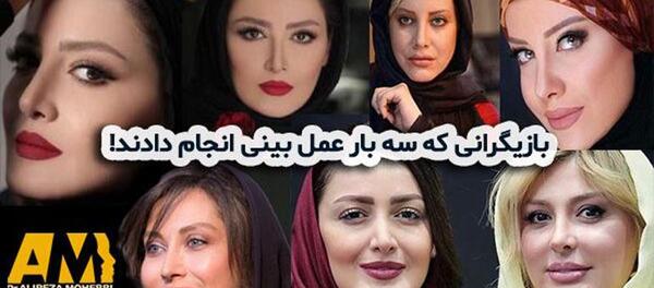 عکس نیوشا ضیغمی بعد از عمل بینی