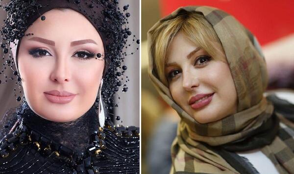 عکس نیوشا ضیغمی بعد از عمل بینی