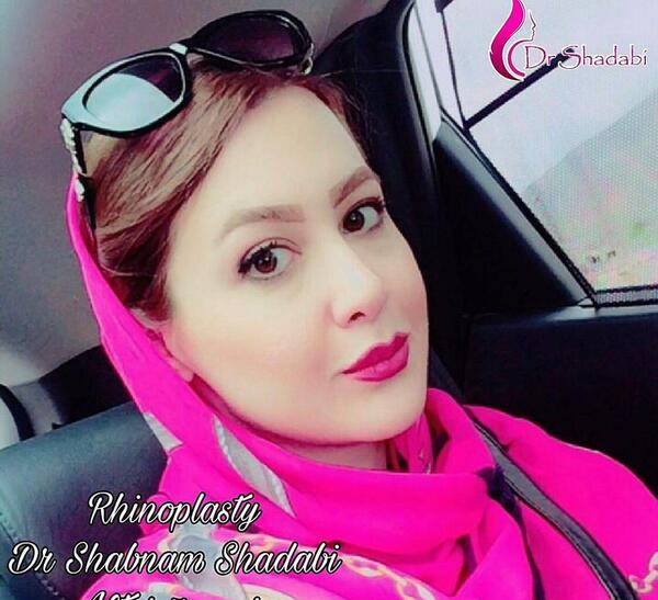 عکس نیوشا ضیغمی بعد از عمل بینی
