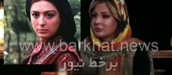 عکس نیوشا ضیغمی بعد از عمل بینی