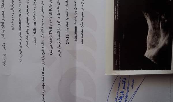 عکس بارداری خارج از رحم