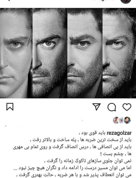 عکس صورت محمدرضا گلزار