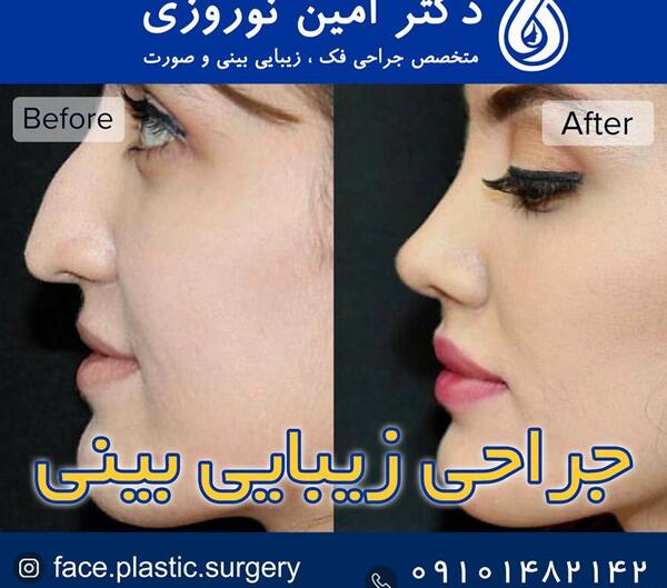عکس نگین روی دماغ