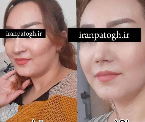 عکس نگین روی دماغ