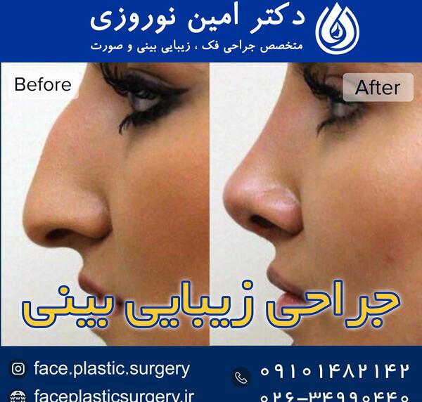 عکس نگین روی دماغ