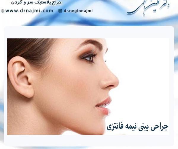 عکس نگین روی دماغ