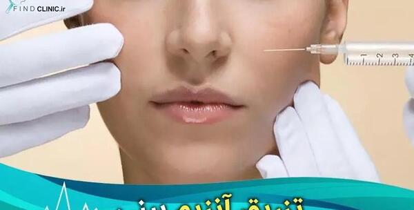 عکس نگین روی دماغ