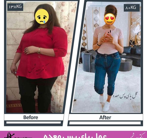 عکس آرون افشار بعد لاغری