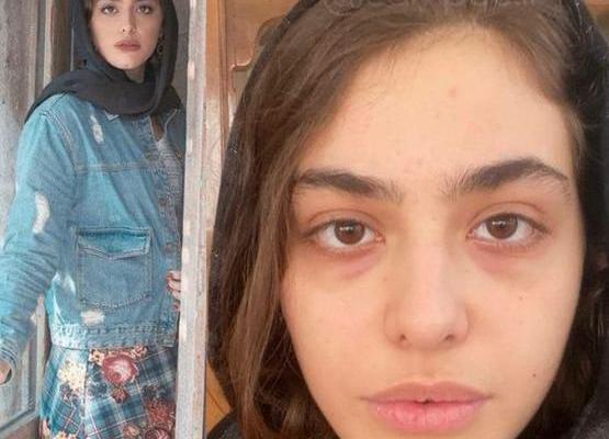 عکس دنیا غزل خواننده افغانی