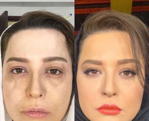 عکس ملیکا شریفی نیا