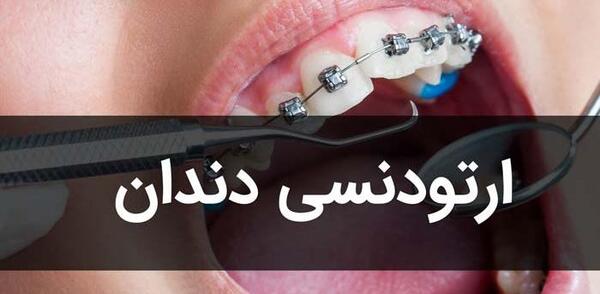 عکس نگین های ارتودنسی