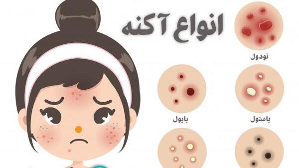 عکس سفید صورت